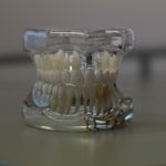 Zła metoda odżywiania się to większe braki w zębach oraz także ich zgubę